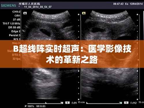 B超线阵实时超声：医学影像技术的革新之路