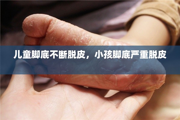 儿童脚底不断脱皮,小孩脚底严重脱皮